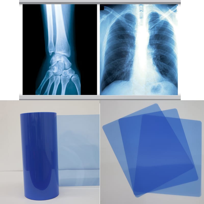 xray film adult